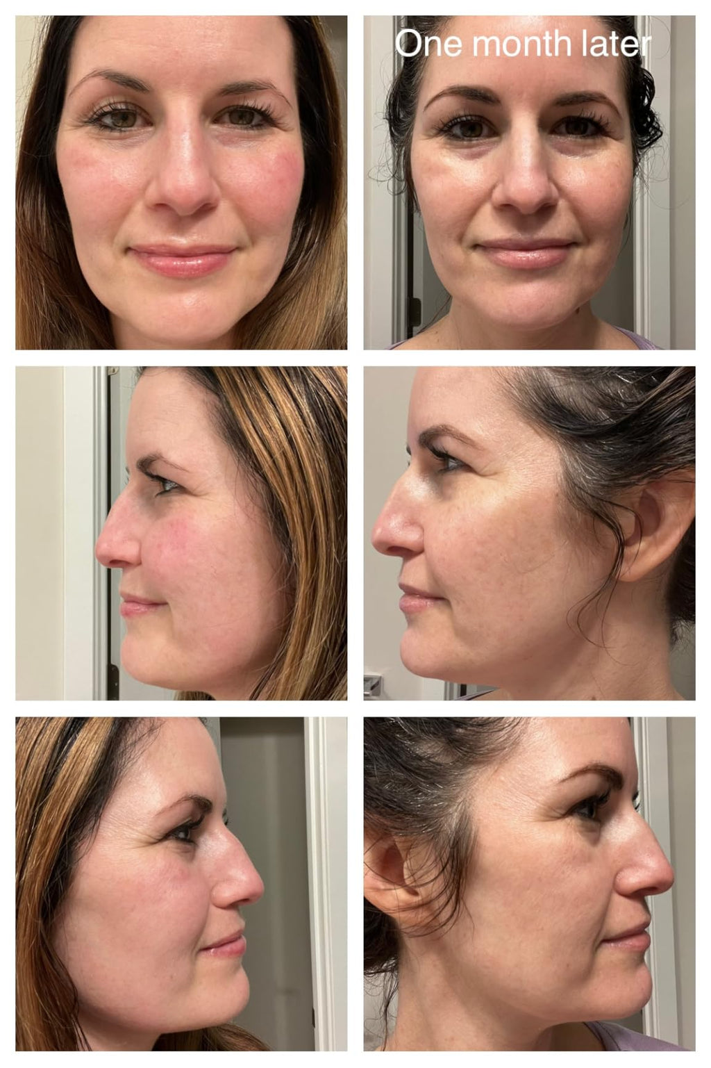 CeraVe Vitamin C Serum with Hyaluronic Acid & Ceramides – Brightening & Hydrating Face Serum